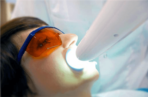 Understanding the Causes of Teeth Sensitivity Maidstone