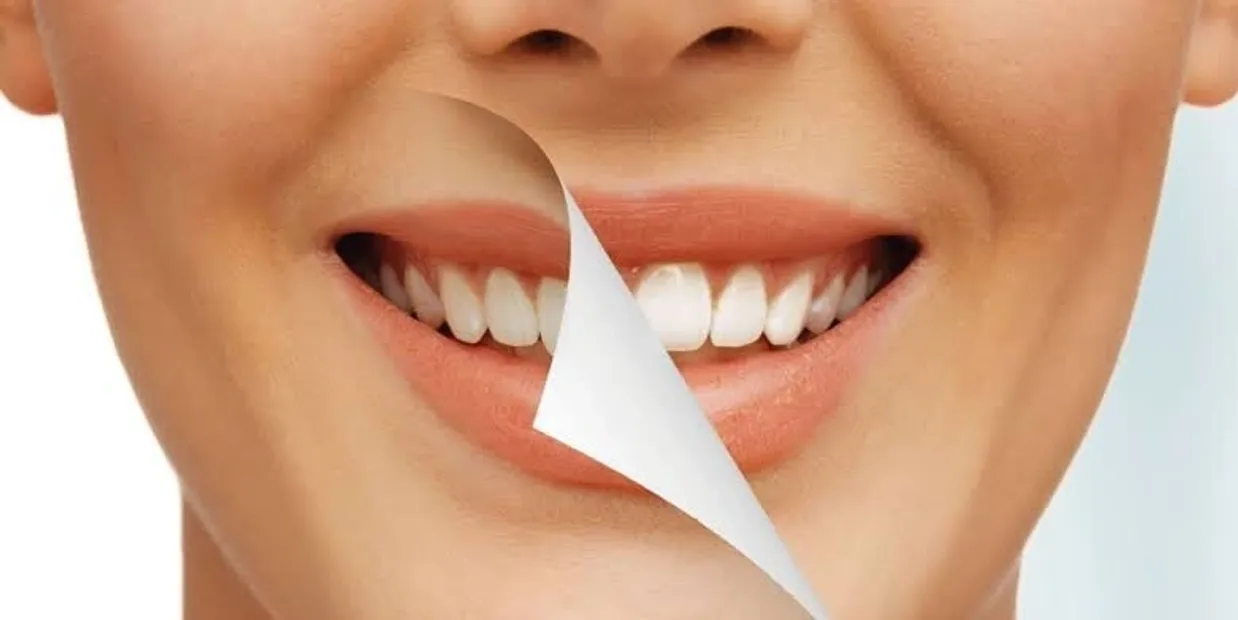 Can Laser Teeth Whitening Damage Your Dental Crowns Maidstone?