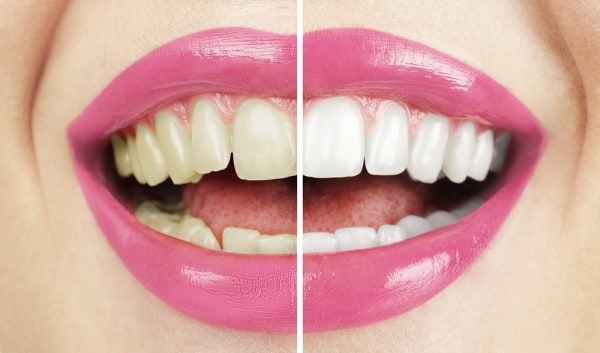 What Early Signs of Oral Cancer Should You Never Ignore Maidstone?