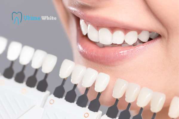 How to Maximise the Results of Your Laser Teeth Whitening Treatment Maidstone