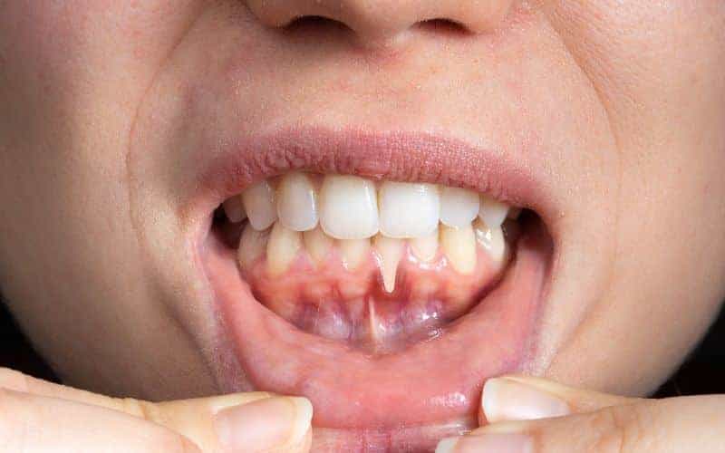 Final Thoughts: Building Lifelong Enamel Protection Habits Maidstone