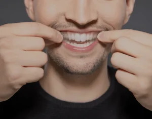 Overview of Home Teeth Whitening Kits Maidstone