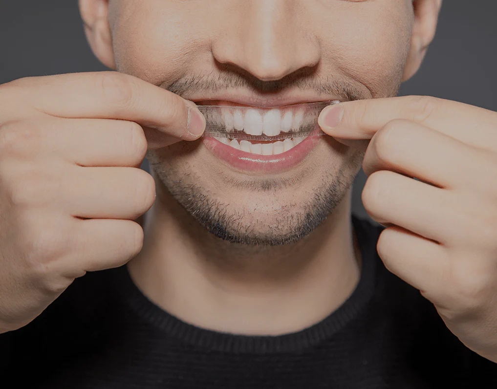 How Are Invisible Aligners Changing Orthodontic Treatments Maidstone?