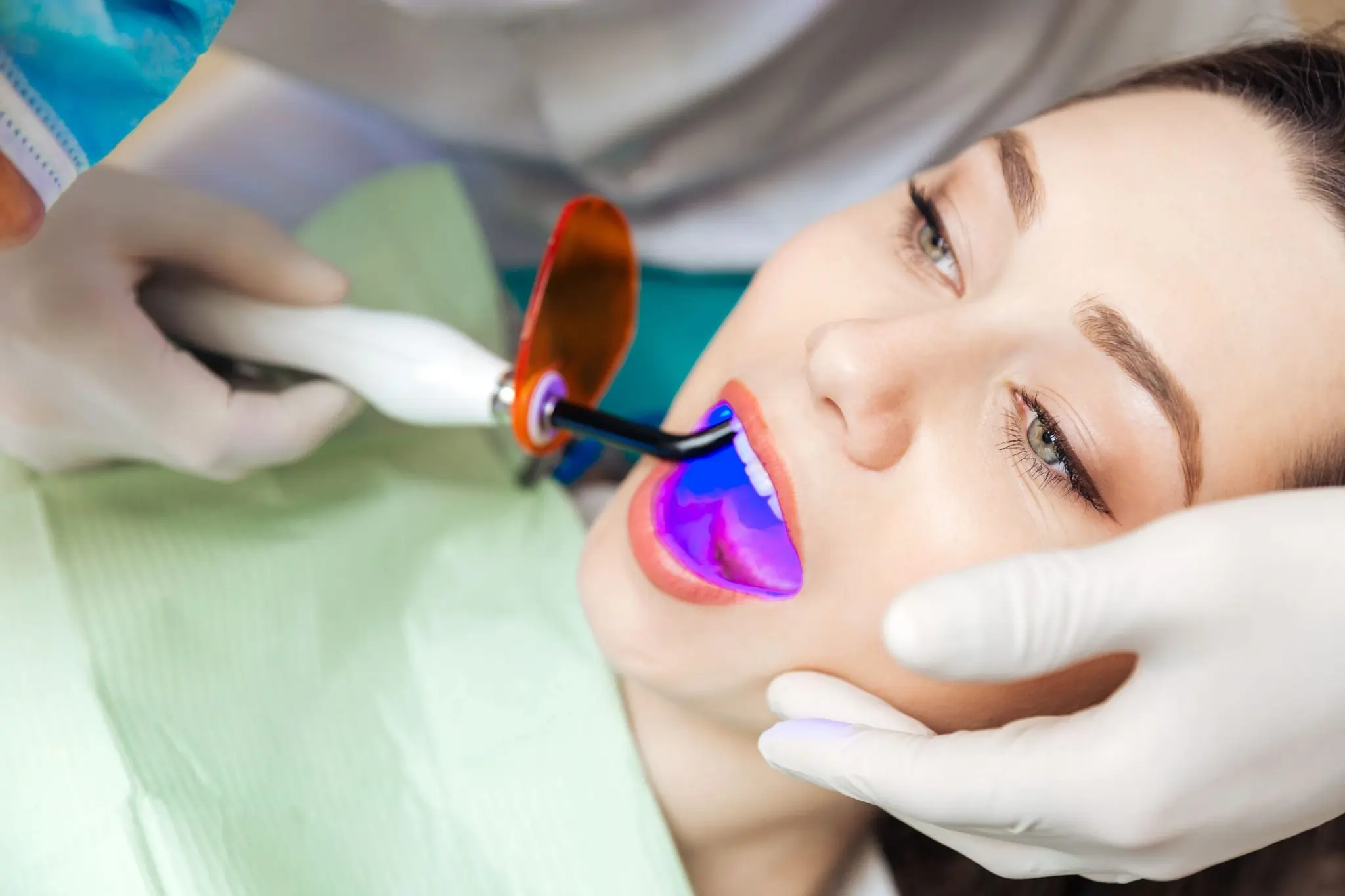 What You Need to Know Before Brightening Your Smile Maidstone