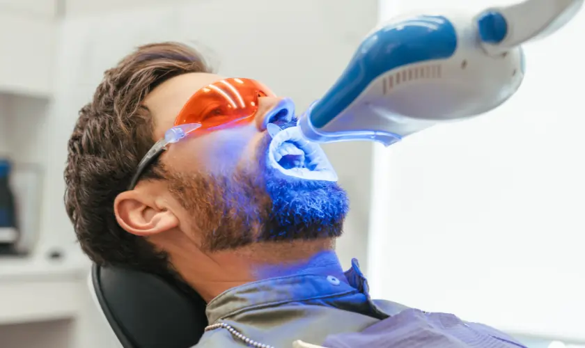 What Is Laser Teeth Whitening and How Does It Work Maidstone?