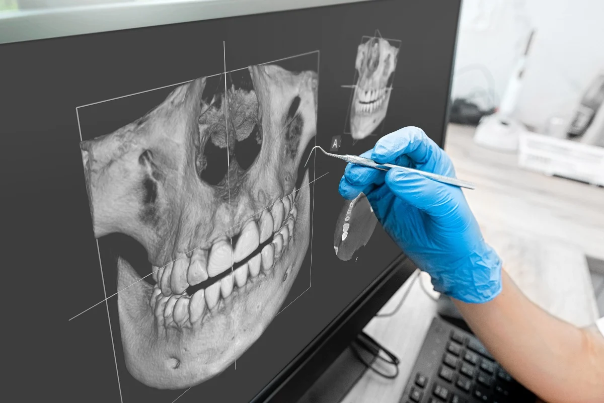 Key Benefits of 3D Printing for Patients and Dentists Maidstone