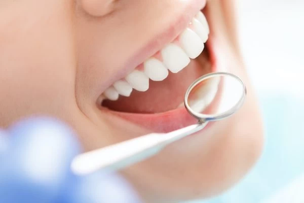How Do You Choose the Right Cosmetic Dentist Maidstone?