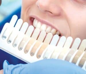 Ultimate Guide to Teeth Whitening with Natural Ingredients Maidstone
