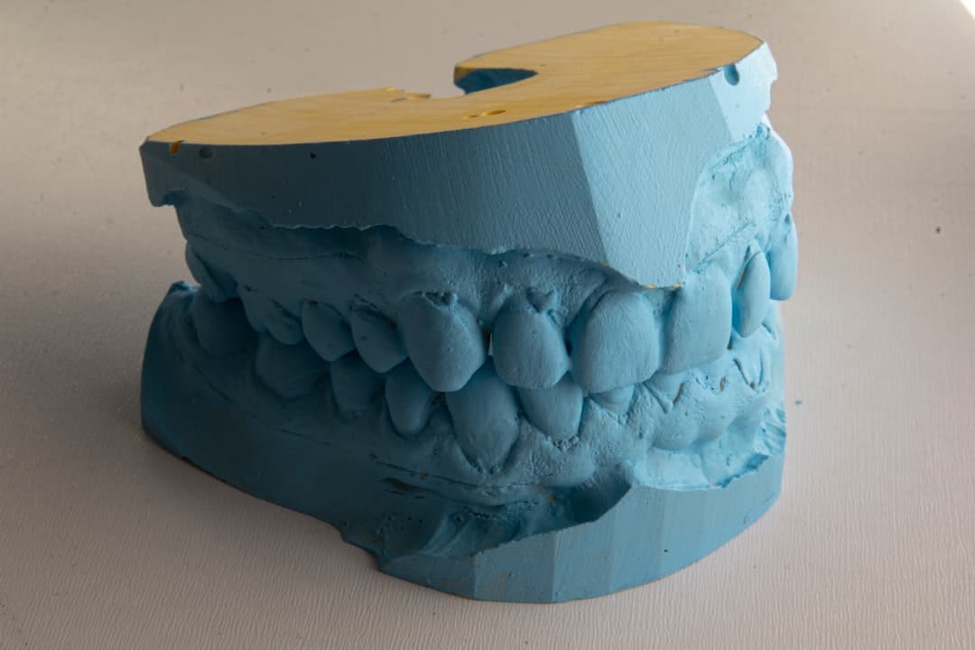 How Do Dental Implants Improve Jawbone Health and Oral Function Maidstone?