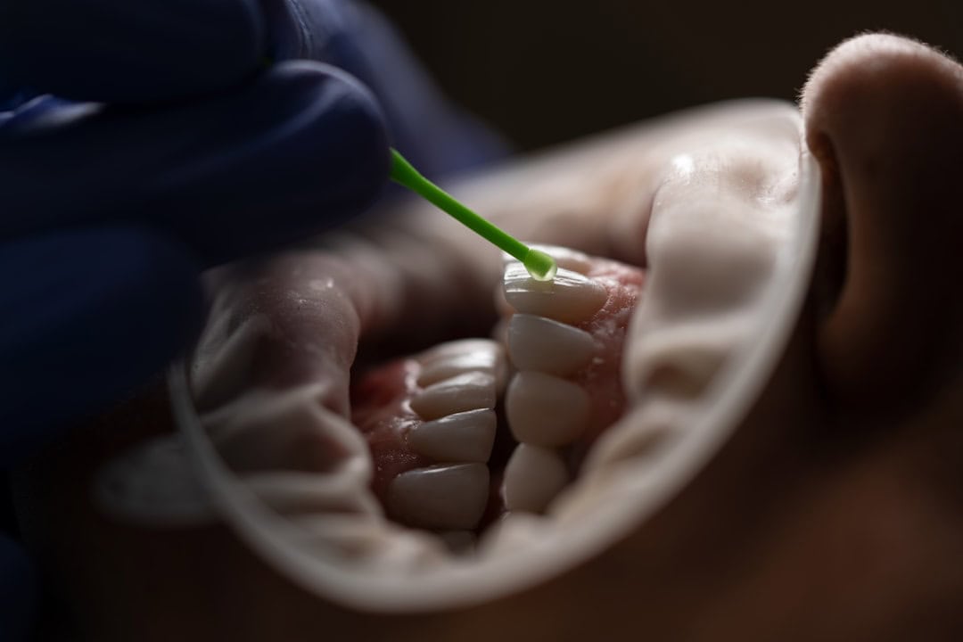 Common Causes of Persistent Dry Mouth Maidstone
