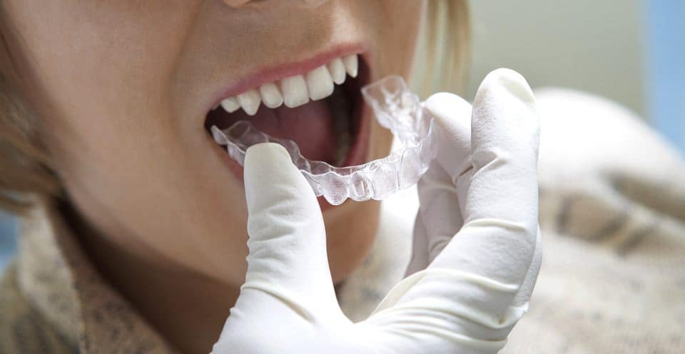 Can Bruxism Affect Your Sleep Quality Maidstone