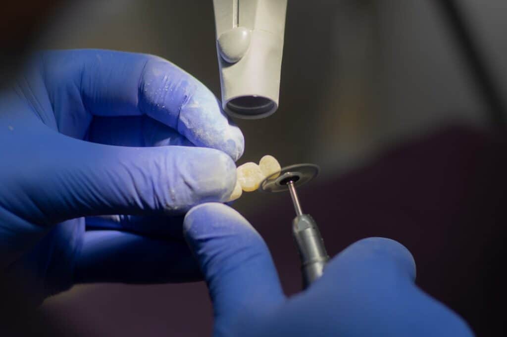 Customised Dental Solutions: Crowns, Aligners, and Implants Maidstone