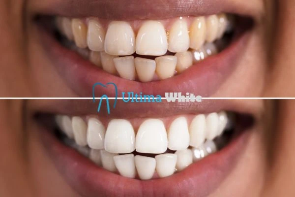 Long lasting results from Ultima White Maidstone